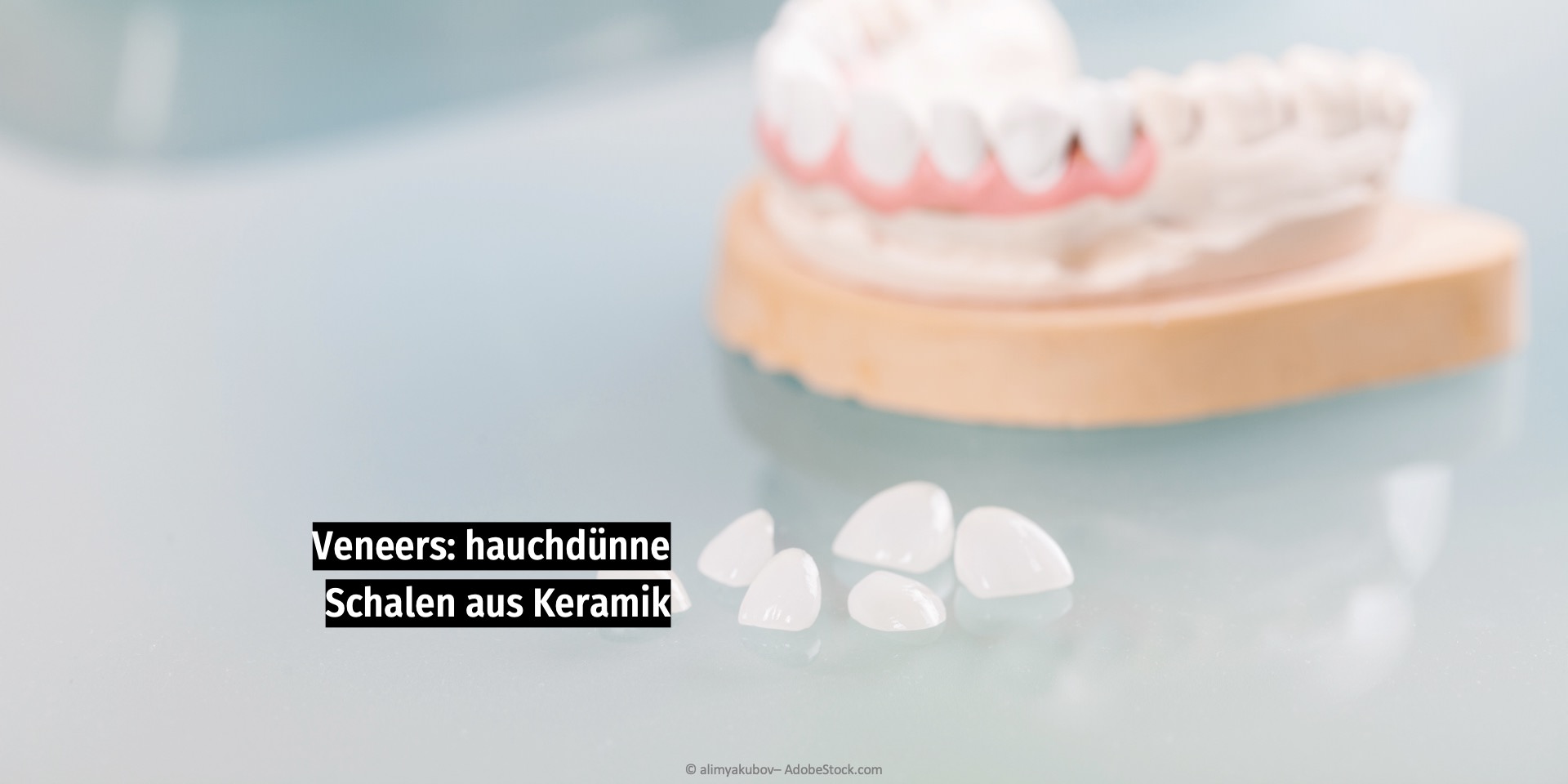 Veneers: hauchdünne Keramikverblendschalen